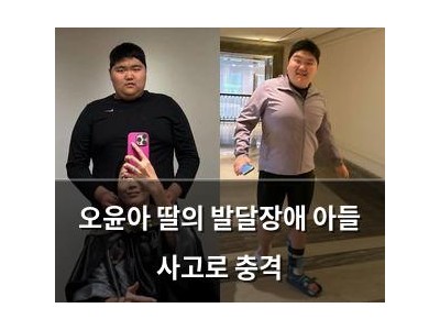 오윤아 딸의 발달장애 아들 사고로 충격