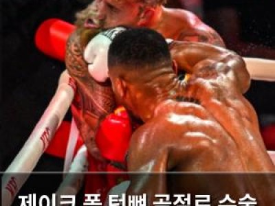 제이크 폴 턱뼈 골절로 수술 후 근황 전해
