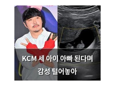 KCM 세 아이 아빠 된다며 감성 털어놓아