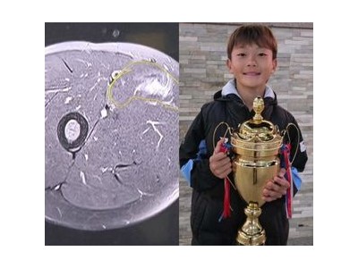 이동국 아내 막내아들 부상 소식에 눈물 흘리다